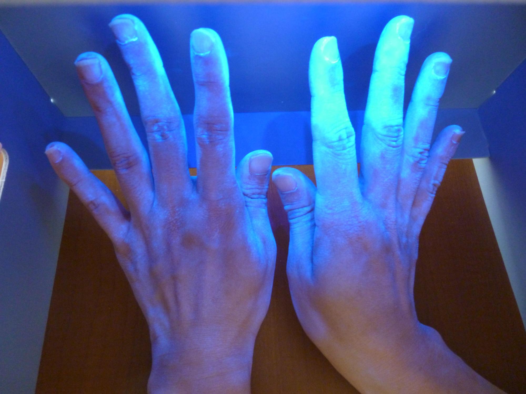 指先が青白く光っている両手の甲の写真